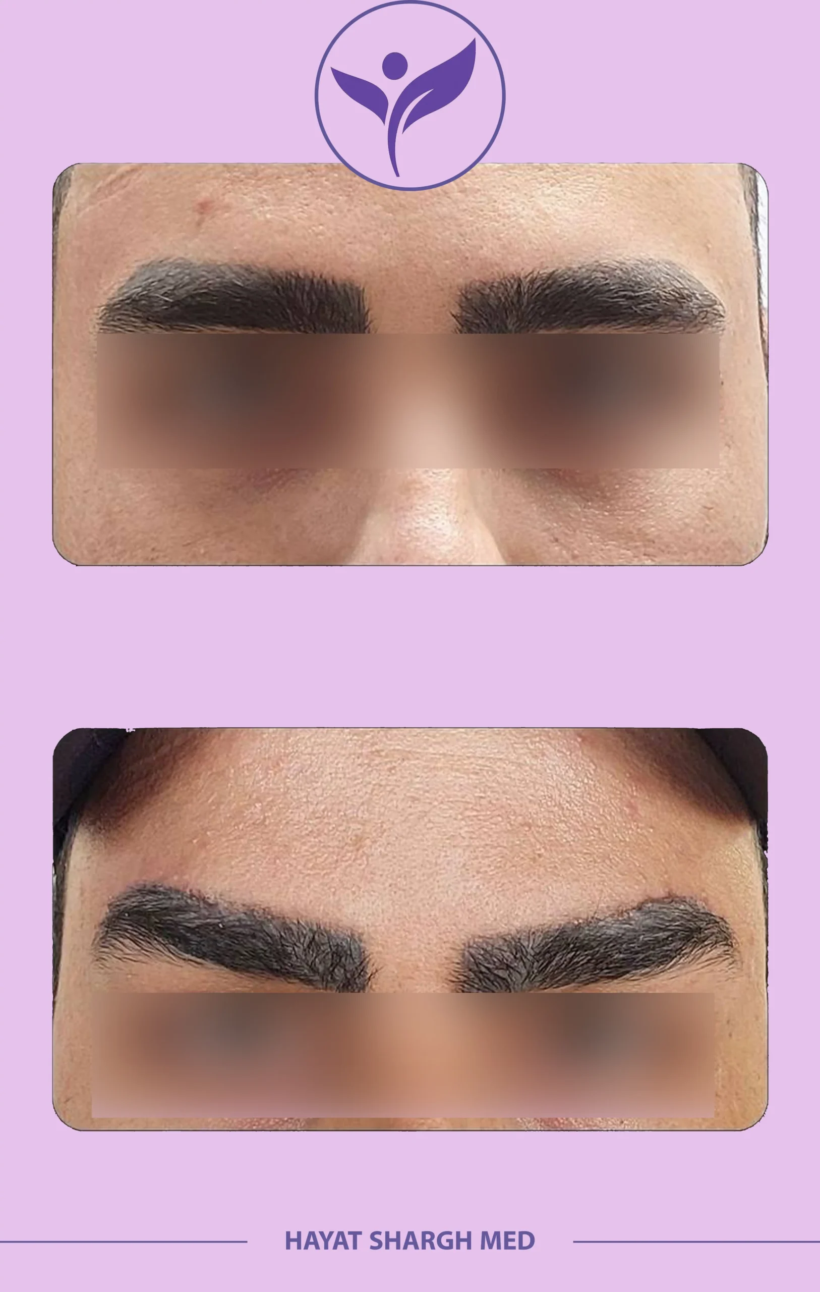 نماذج قبل و بعد 1 21 scaled